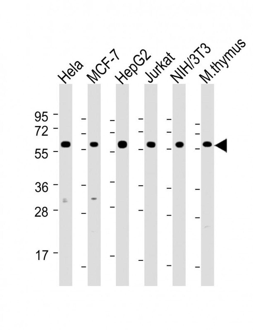 Western Blot at 1:2000 dilution Lane 1: Hela whole cell lysate Lane 2: MCF-7 whole cell lysate Lane 3: HepG2 whole cell lysate Lane 4: Jurkat whole cell lysate Lane 5: NIH/3T3 whole cell lysate Lane 6: mouse thymus lysate Lysates/proteins at 20 ug per lane.