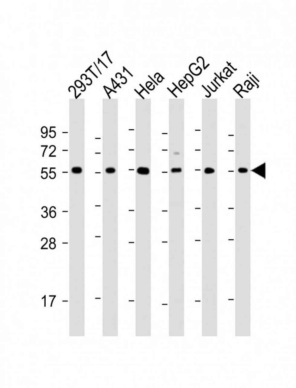 Western Blot at 1:2000 dilution Lane 1: 293T/17 whole cell lysate Lane 2: A431 whole cell lysate Lane 3: Hela whole cell lysate Lane 4: HepG2 whole cell lysate Lane 5: Jurkat whole cell lysate Lane 6: Raji whole cell lysate Lysates/proteins at 20 ug per lane.