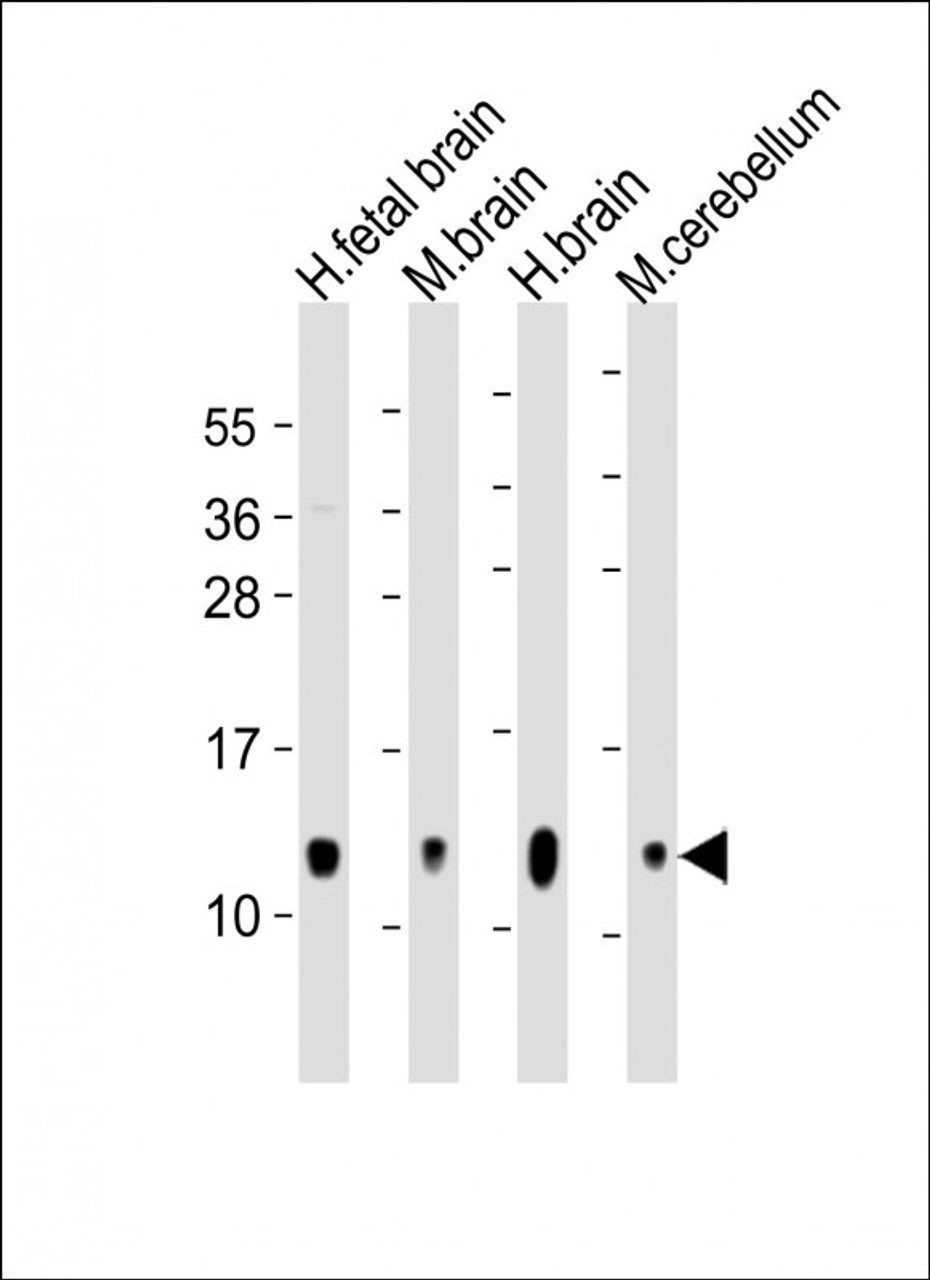 Western Blot at 1:2000 dilution Lane 1: human fetal brain lysate Lane 2: mouse brain lysate Lane 3: human brain lysate Lane 4: mouse cerebellum lysate Lysates/proteins at 20 ug per lane.