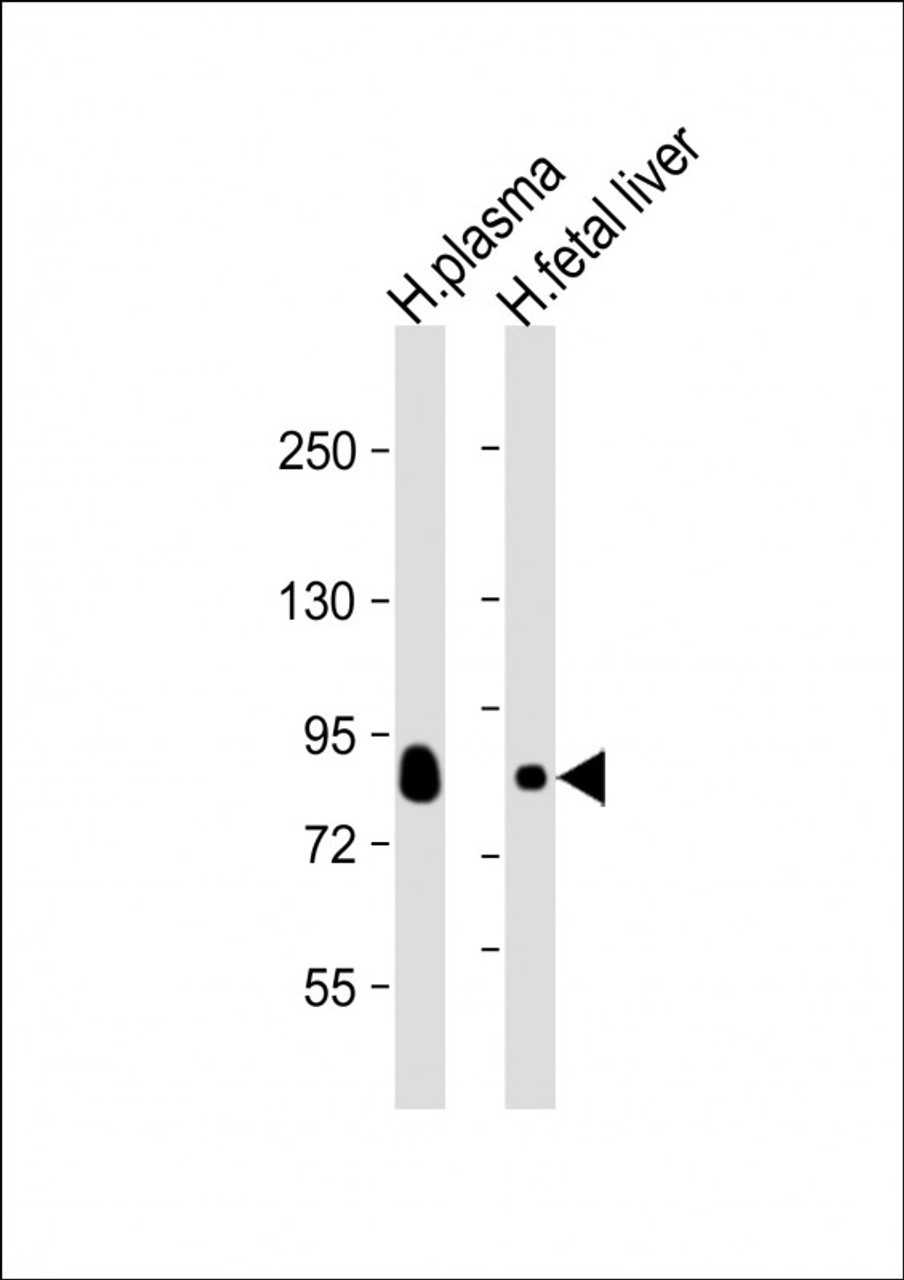 Western Blot at 1:2000 dilution Lane 1: human plasma lysate Lane 2: human fetal liver lysate Lysates/proteins at 20 ug per lane.