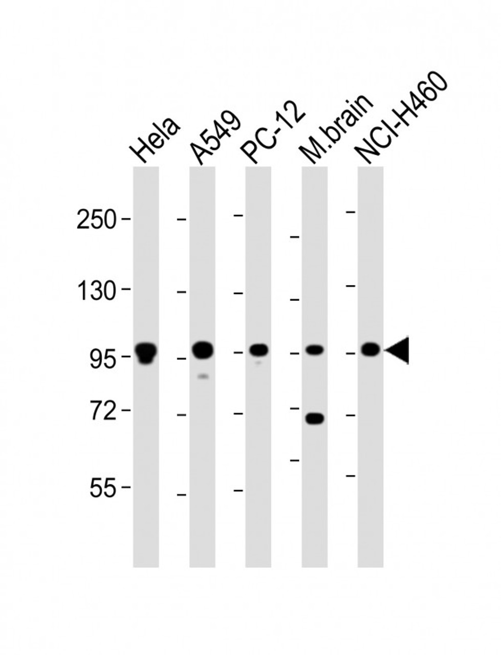 Western Blot at 1:2000 dilution Lane 1: Hela whole cell lysate Lane 2: A549 whole cell lysate Lane 3: PC-12 whole cell lysate Lane 4: mouse brain lysate Lane 5: NCI-H460 whole cell lysate Lysates/proteins at 20 ug per lane.