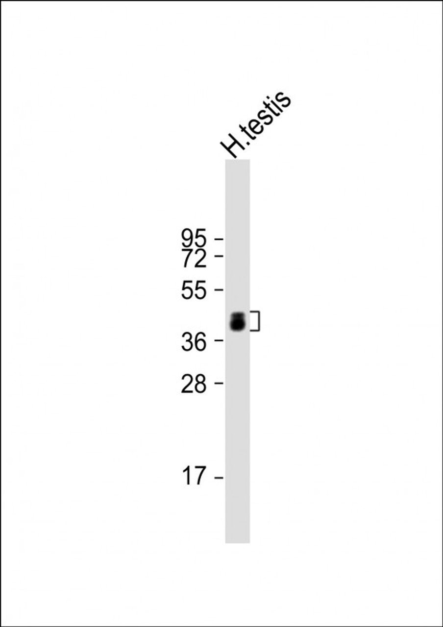 Western Blot at 1:4000 dilution + human testis lysate Lysates/proteins at 20 ug per lane.