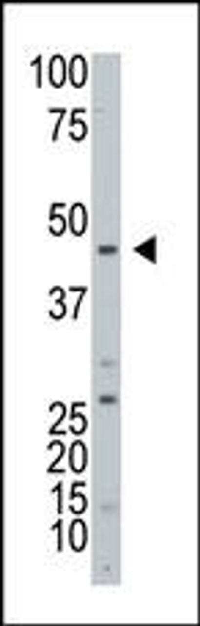 Western blot analysis of ART3 Antibody in HL60 cell line lysates (25ug/lane) .