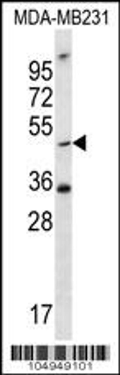 Western blot analysis in MDA-MB231 cell line lysates (35ug/lane) .