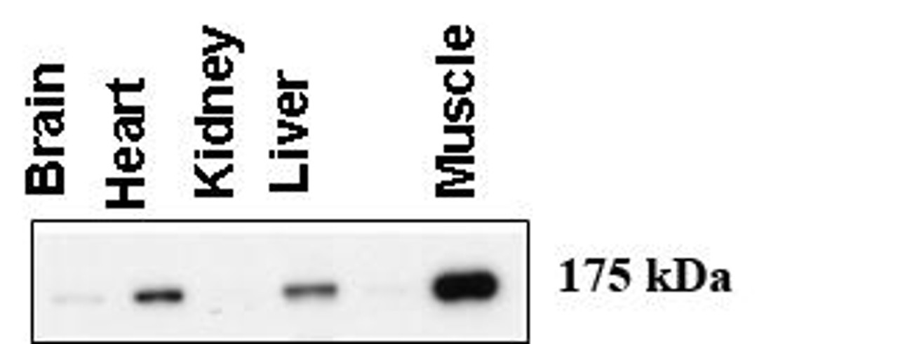 Western blot using anti-AGL antibody at 1:1000 dilution. A total of 20 ug of lysates was loaded for each tissue. Data courtesy of Dr. Alan Cheng, Department of Internal Medicine, Life Sciences Institute, University of Michigan Medical Center, Ann Arbor, Michigan.