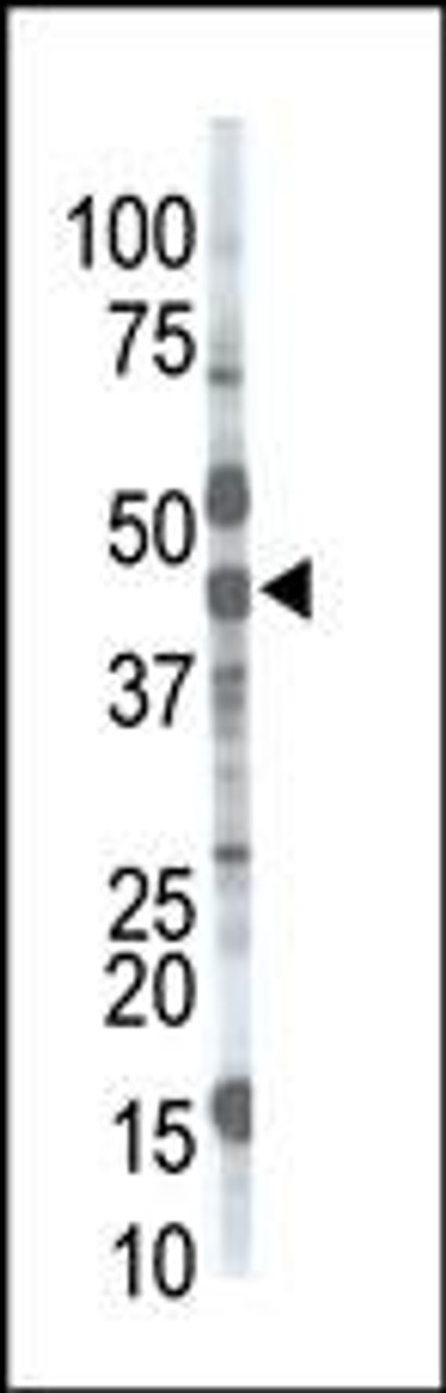 Antibody is used in Western blot to detect MGAT1 in mouse brain tissue lysate.