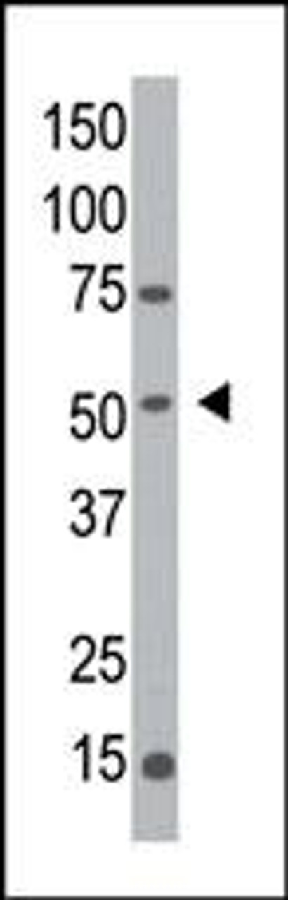 Western blot analysis of anti-hMGAT1-R426 Pab in Y79 cell line lysate.