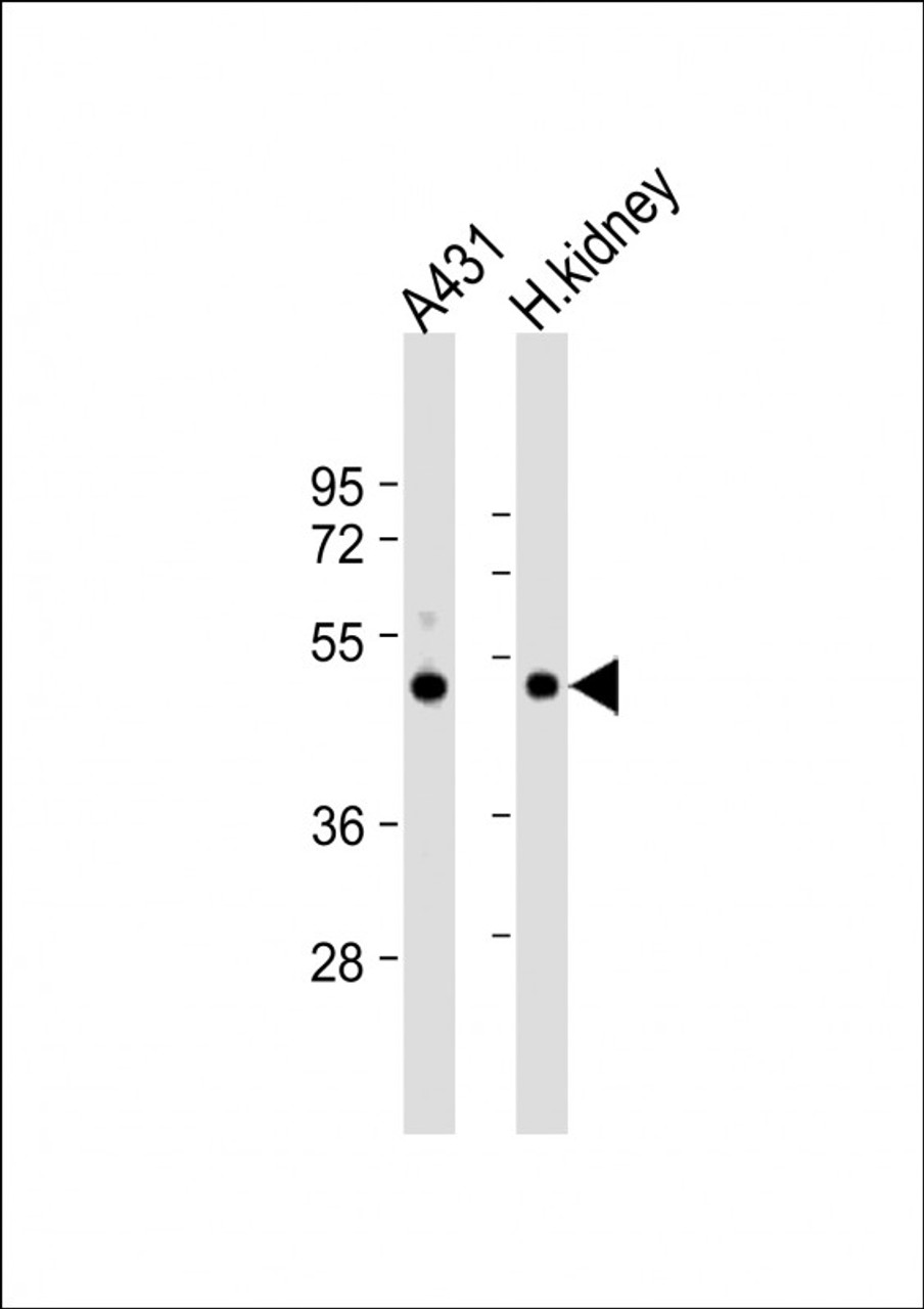 Western Blot at 1:1000 dilution Lane 1: A431 whole cell lysate Lane 2: human kidney lysate Lysates/proteins at 20 ug per lane.