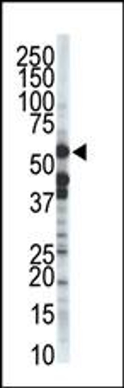 Antibody is used in Western blot to detect ZMPSTE24 in T-47D cell lysate.