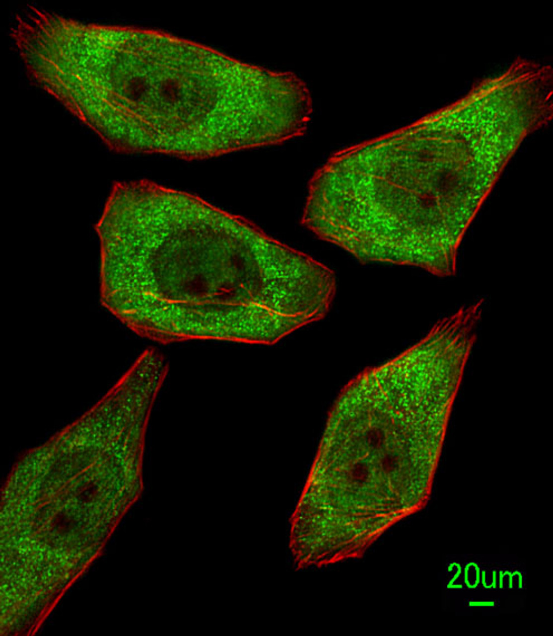 Immunofluorescent analysis of A549 cells, using FDPS Antibody . Antibody was diluted at 1:100 dilution. Alexa Fluor 488-conjugated goat anti-rabbit lgG at 1:400 dilution was used as the secondary antibody (green) . Cytoplasmic actin was counterstained with Dylight Fluor 554 (red) conjugated Phalloidin (red) .
