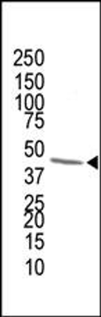 Antibody is used in Western blot to detect FDPS in human cytokeratin liver cell lysate. Data is kindly provided by Dr. Masaru Harada from Stanford University (Palo Alto, CA) .