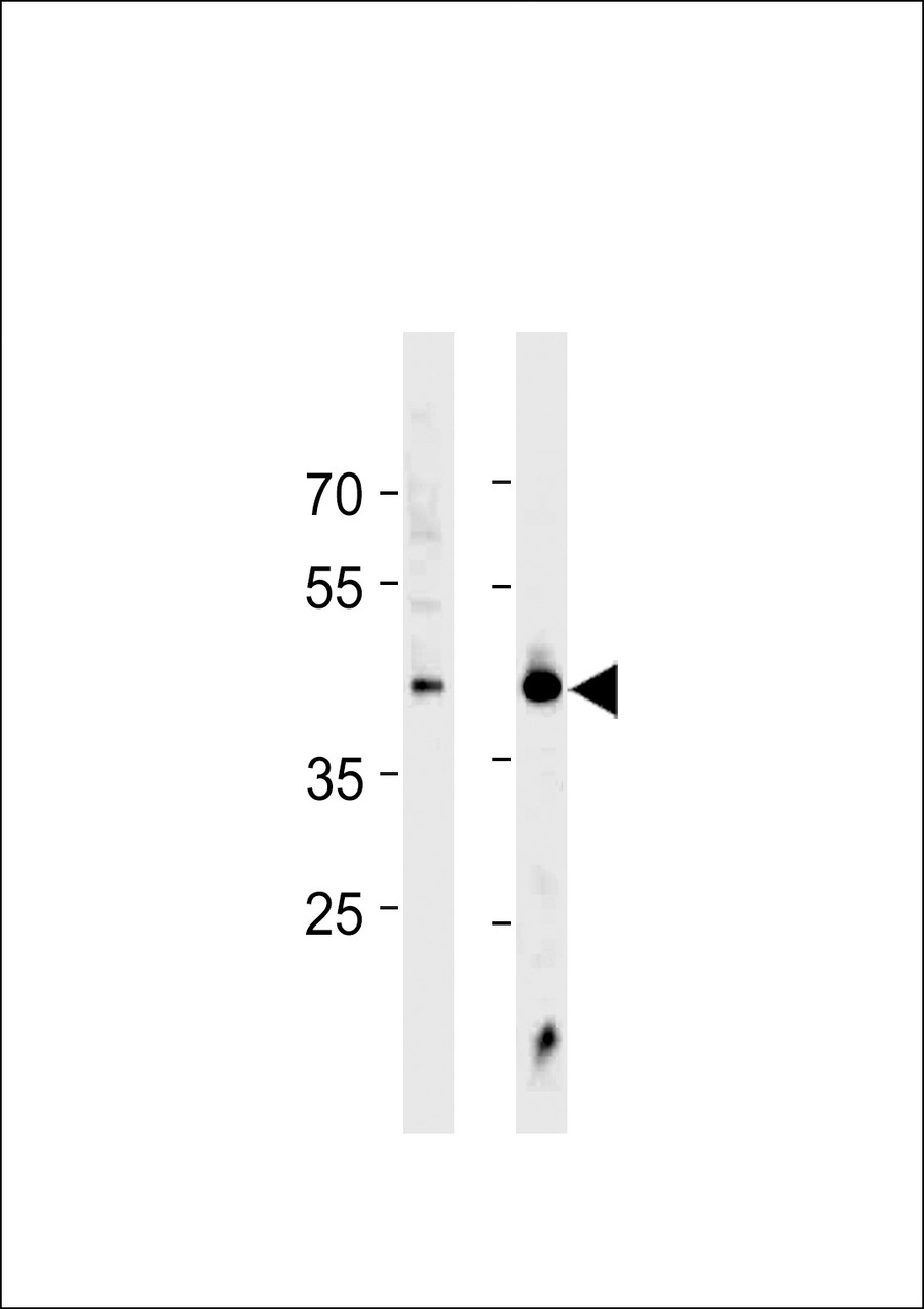 Western blot analysis in Jurkat cell line and mouse heart tissue lysates (35ug/lane) .