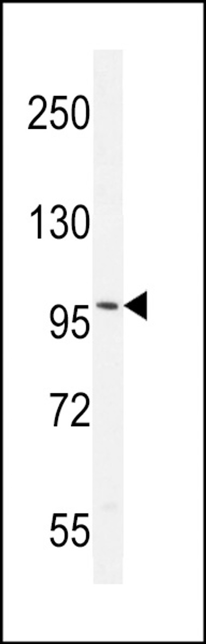 Western blot analysis in mouse brain tissue lysates (35ug/lane) .This demonstrates the AR antibody detected the AR protein (arrow) .