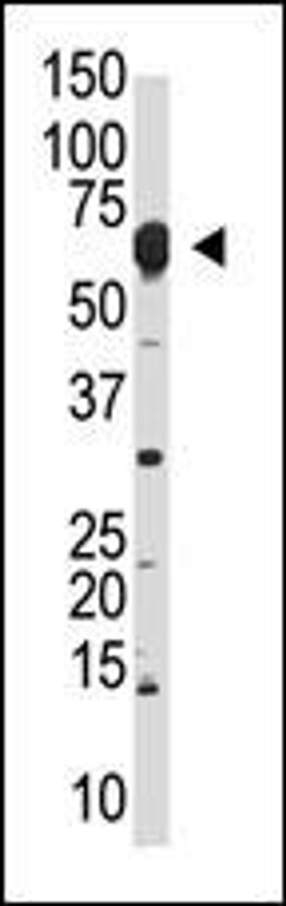 Antibody is used in Western blot to detect NYREN18 in mouse liver lysate.