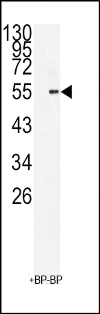 Western blot analysis of BMI1 Antibody antibodyin 293 cell line lysates (35ug/lane)