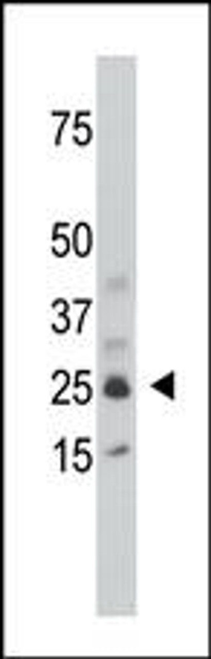 Antibody is used in Western blot to detect SULT1C1 in mouse kidney tissue lysate.