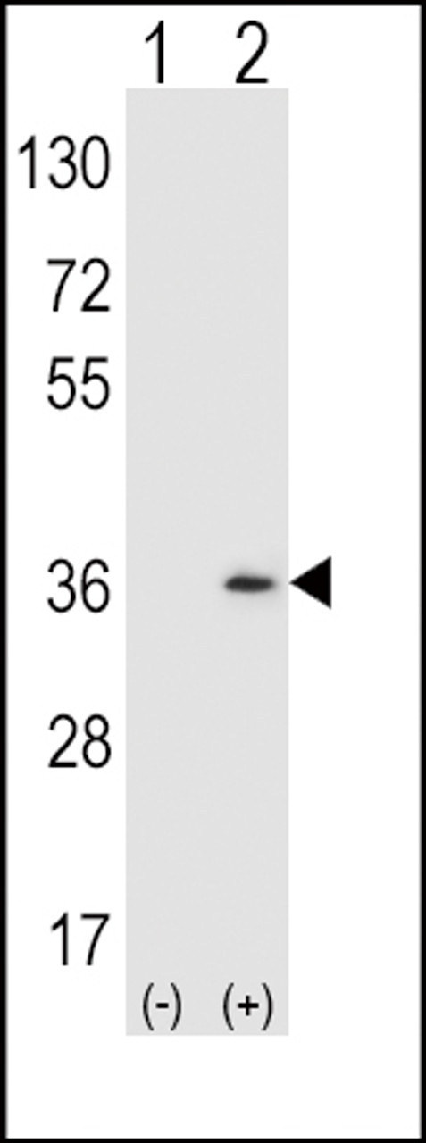 Western blot analysis of SULT1A1 using rabbit polyclonal SULT1A1 Antibody (Y143) using 293 cell lysates (2 ug/lane) either nontransfected (Lane 1) or transiently transfected (Lane 2) with the SULT1A1 gene.