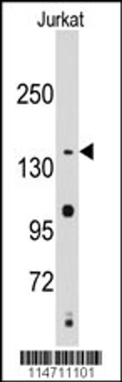 Western blot analysis of anti-SMC2 Antibody in Jurkat cell line lysates (35ug/lane)