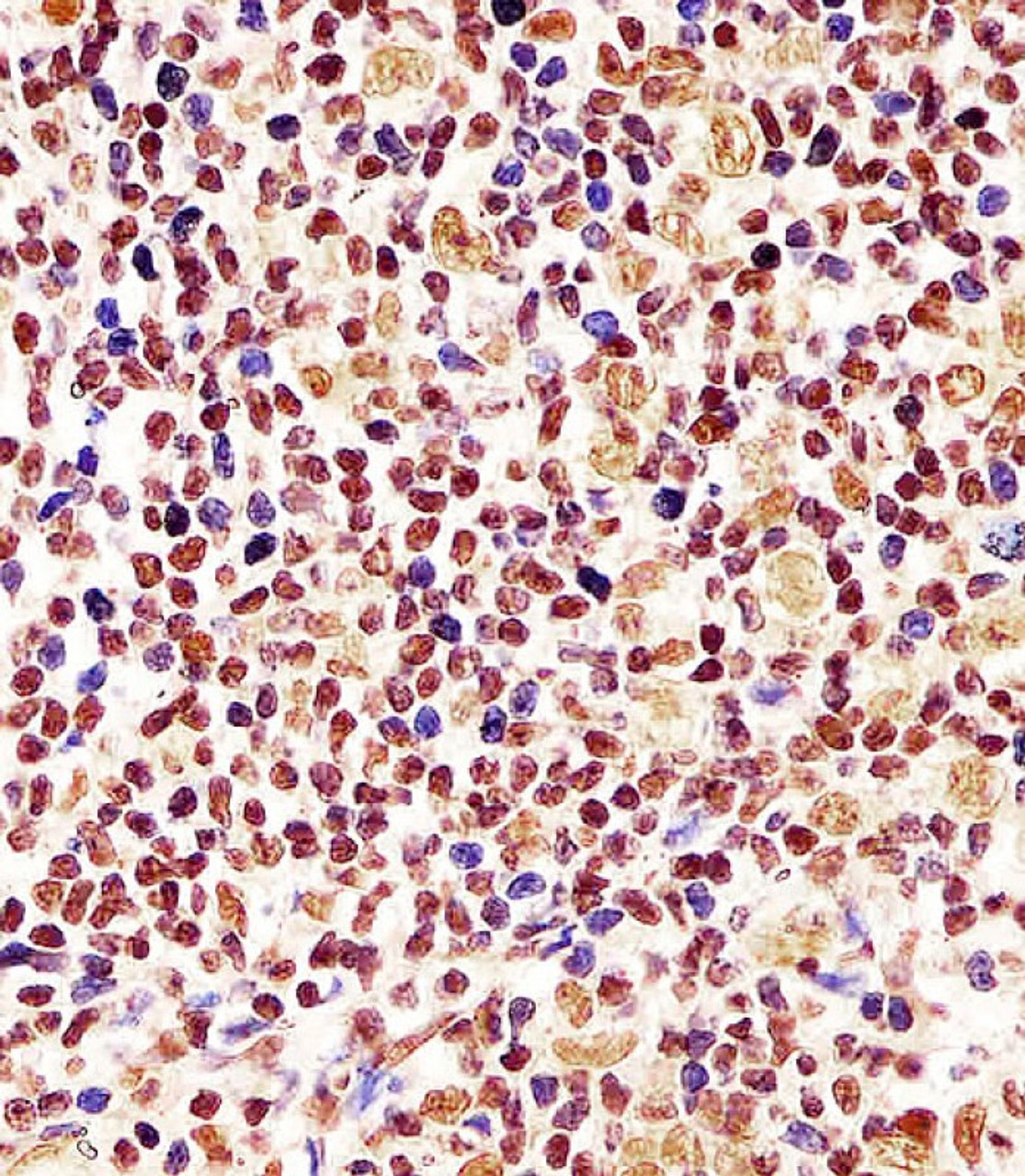 Antibody staining Cyclin D1 in human tonsil tissue sections by Immunohistochemistry (IHC-P - paraformaldehyde-fixed, paraffin-embedded sections) .