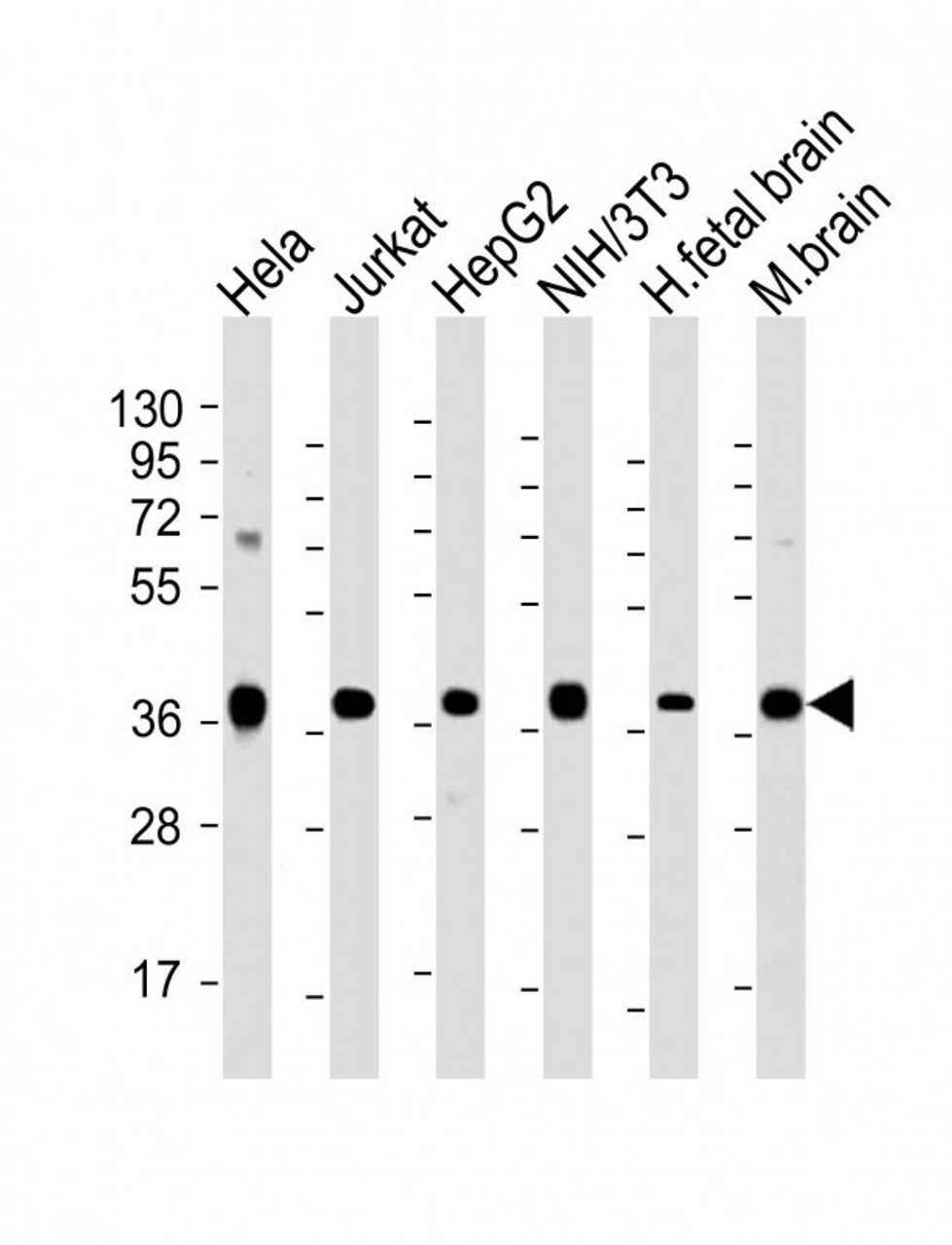 Western Blot at 1:2000 dilution Lane 1: Hela whole cell lysate Lane 2: Jurkat whole cell lysate Lane 3: HepG2 whole cell lysate Lane 4: NIH/3T3 whole cell lysate Lane 5: human fetal brain lysate Lane 6: mouse brain lysate Lysates/proteins at 20 ug per lane.