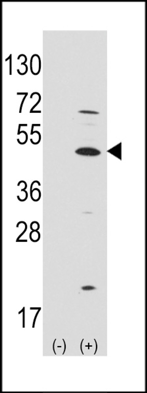 Western blot analysis of ATOH1 using rabbit polyclonal ATOH1 Antibody.293 cell lysates (2 ug/lane) either nontransfected (Lane 1) or transiently transfected with the ATOH1 gene (Lane 2) .