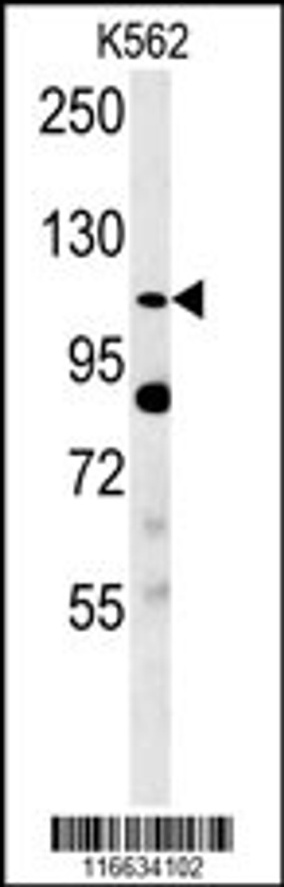 Western blot analysis in K562 cell line lysates (35ug/lane) .This demonstrates the Semaphorin 5A antibody detected the Semaphorin 5A protein (arrow) .