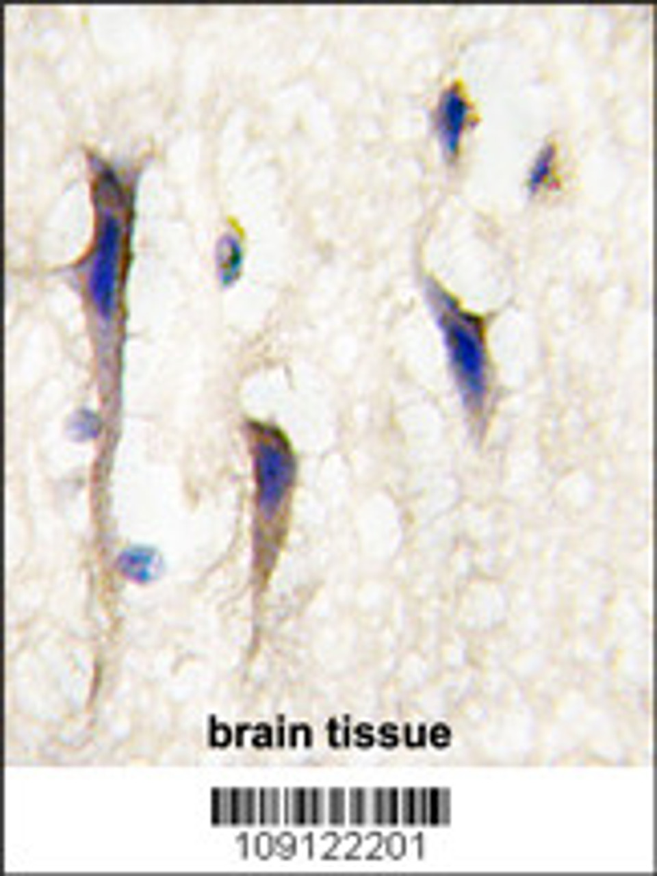 Formalin-fixed and paraffin-embedded human brain tissue reacted with Arhgef9 Antibody, which was peroxidase-conjugated to the secondary antibody, followed by DAB staining.