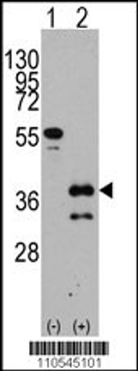 Western blot analysis of ZIC4 using rabbit polyclonal ZIC4 Antibody using 293 cell lysates (2 ug/lane) either nontransfected (Lane 1) or transiently transfected with the ZIC4 gene (Lane 2) .