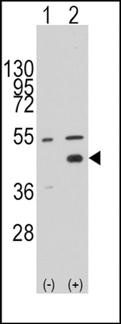 Western blot analysis of WIF1 using rabbit polyclonal WIF1 Antibody using 293 cell lysates (2 ug/lane) either nontransfected (Lane 1) or transiently transfected with the WIF1 gene (Lane 2) .