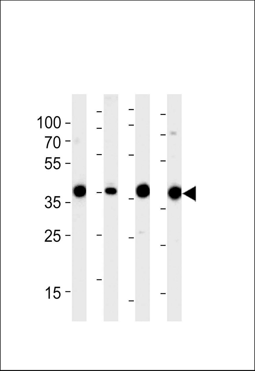 Western blot analysis of lysates from 293, RD, mouse NIH/3T3, rat L6 cell line (from left to right) , using ALDOA Antibody at 1:1000 at each lane.