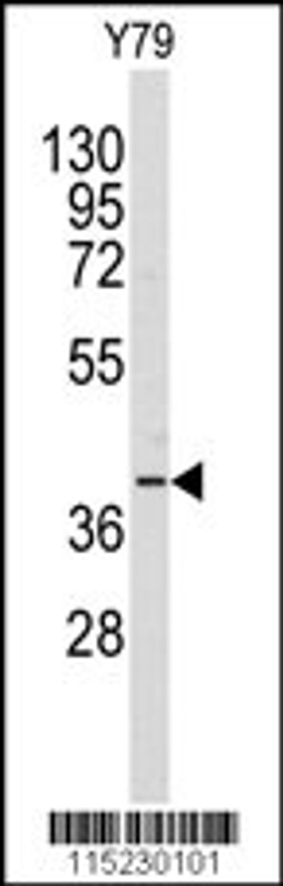Western blot analysis of anti-AKR1A1 Antibody in Y79 cell line lysates (35ug/lane) .