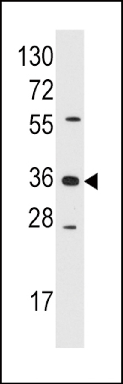 Western blot analysis of anti-AKR1B1 Pab in Jurkat cell line lysates (35ug/lane)