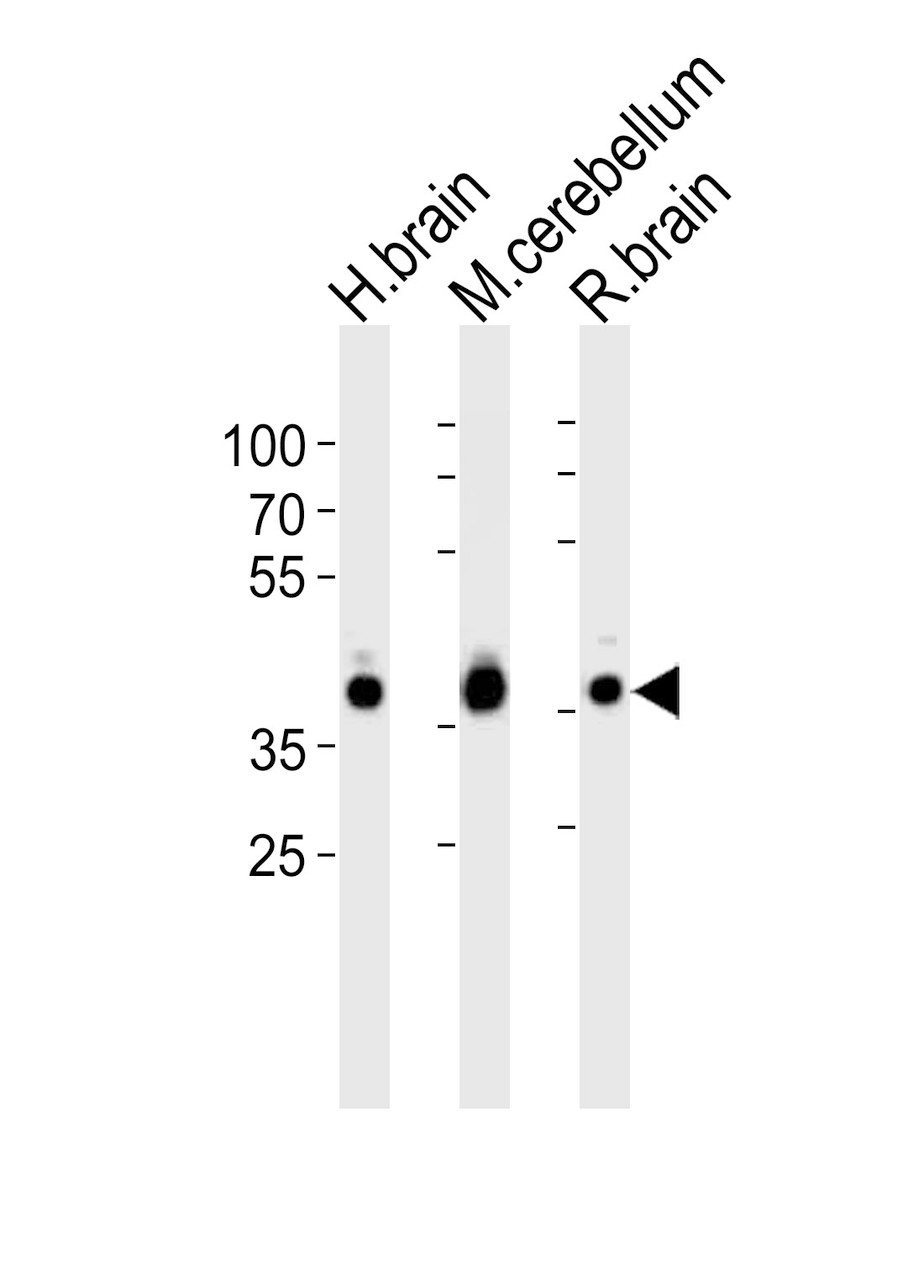 Western blot analysis of lysates from human brain, mouse cerebellum and rat brain tissue lysate (from left to right) , using ALDOC Antibody at 1:1000 at each lane.