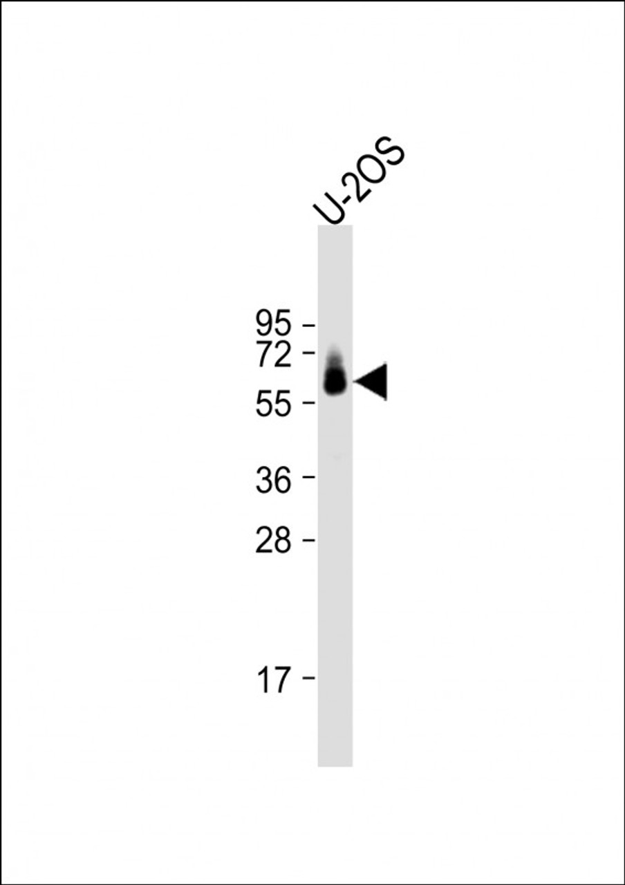 Western Blot at 1:1000 dilution + U-2OS whole cell lysate Lysates/proteins at 20 ug per lane.