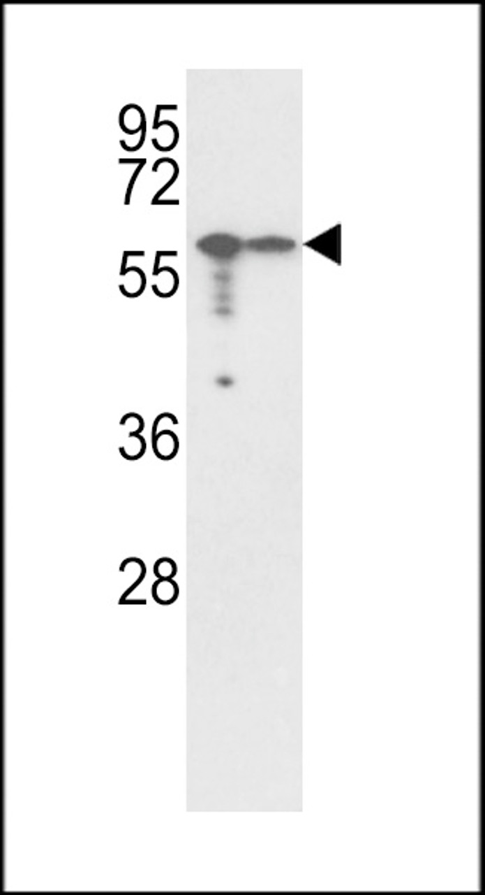 Western blot analysis of Vimentin Antibody in A2058, A375 cell line lysates (35ug/lane)