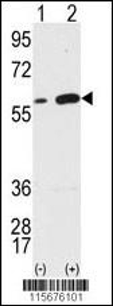 Western blot analysis of Vimentin using Vimentin Antibody using 293 cell lysates (2 ug/lane) either nontransfected (Lane 1) or transiently transfected with the VIM gene (Lane 2) .