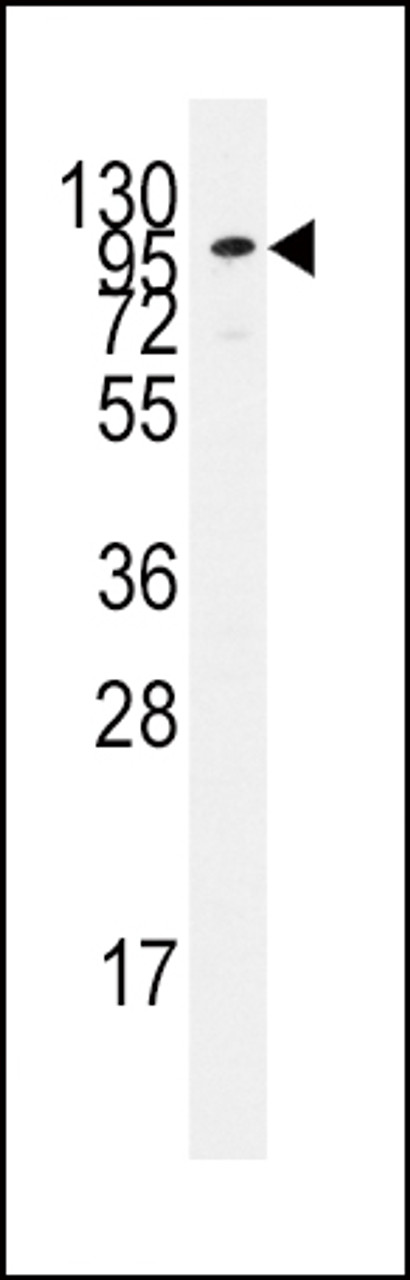 Western blot analysis of anti-ADCY2 Pab in Jurkat cell line lysates (35ug/lane) .