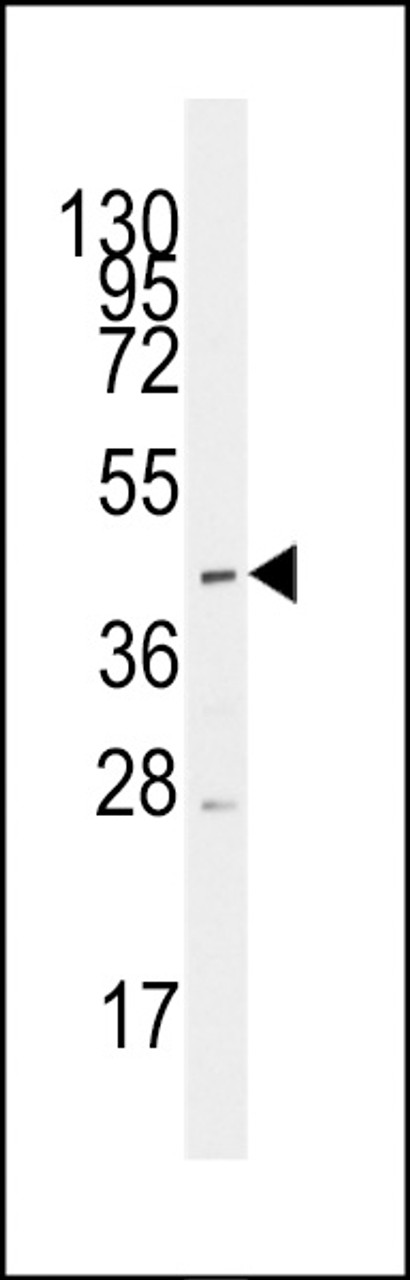 Western blot analysis of anti-SLC16A1 Antibody in CEM cell line lysates (35ug/lane)