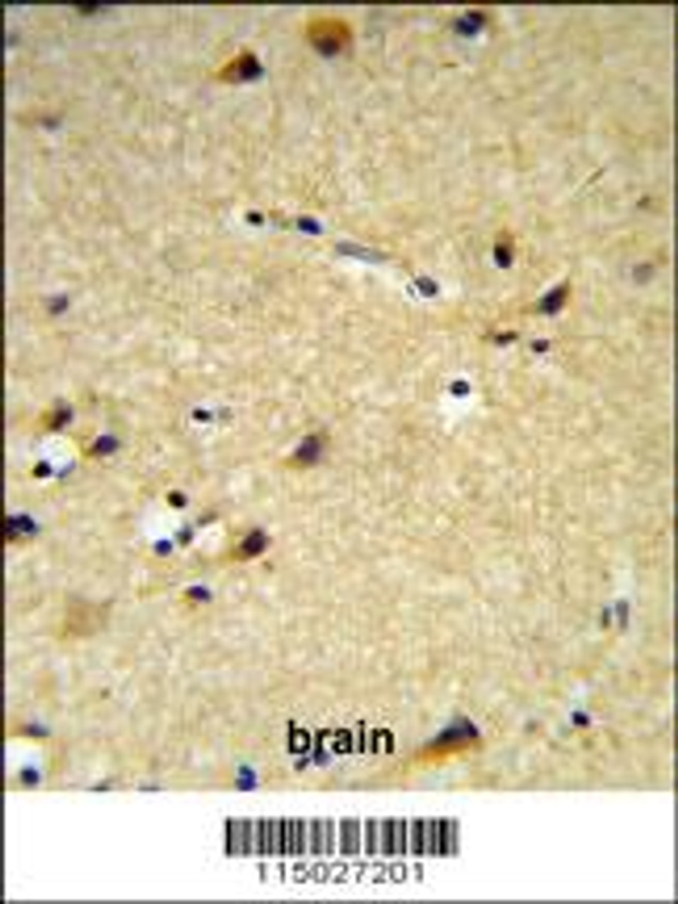 CYP26A1 Antibody IHC analysis in formalin fixed and paraffin embedded brain tissue followed by peroxidase conjugation of the secondary antibody and DAB staining.