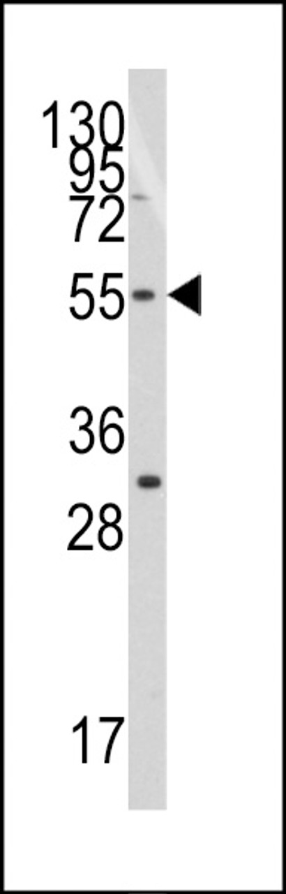 Western blot analysis of anti-TERF1 Pab in Jurkat cell line lysates (35ug/lane) .