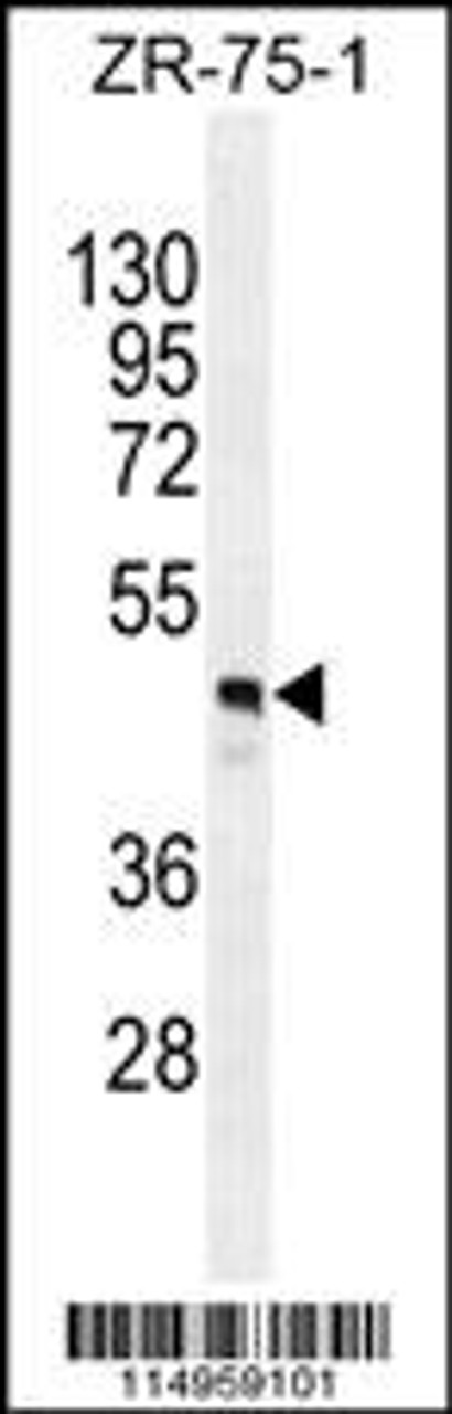 Western blot analysis in ZR-75-1 cell line lysates (35ug/lane) .