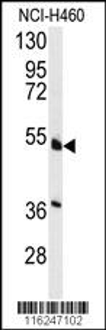 Western blot analysis of anti-HNF4A Antibody (S142) in NCI-H460 cell line lysates (35ug/lane)