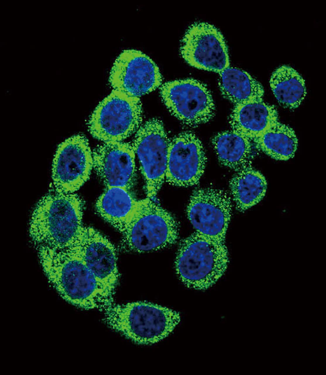 Confocal immunofluorescent analysis of ATXN1 Antibody (S776) with hela cell followed by Alexa Fluor 488-conjugated goat anti-rabbit lgG (green) . DAPI was used to stain the cell nuclear (blue) .