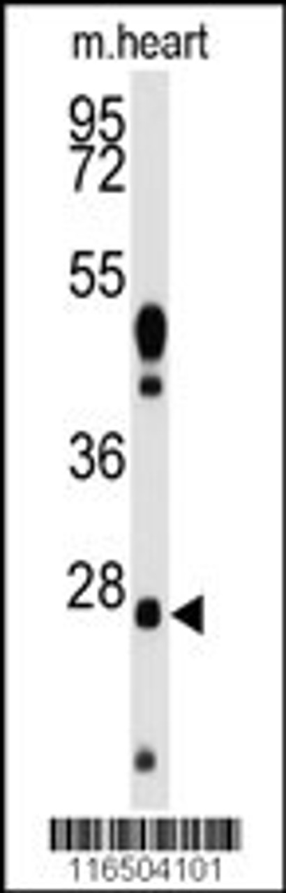 Western blot analysis of anti-WDYHV1 Antibody Pab in mouse heart tissue lysates (35ug/lane) .