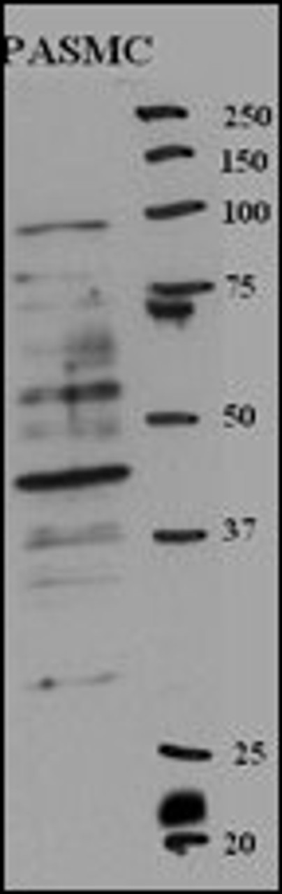 Western blot analysis of anti in rat PASMC cell line lysates (35ug/lane) .