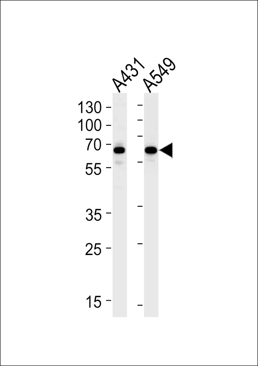 Western blot analysis in A431, A549 cell line lysates (35ug/lane) .