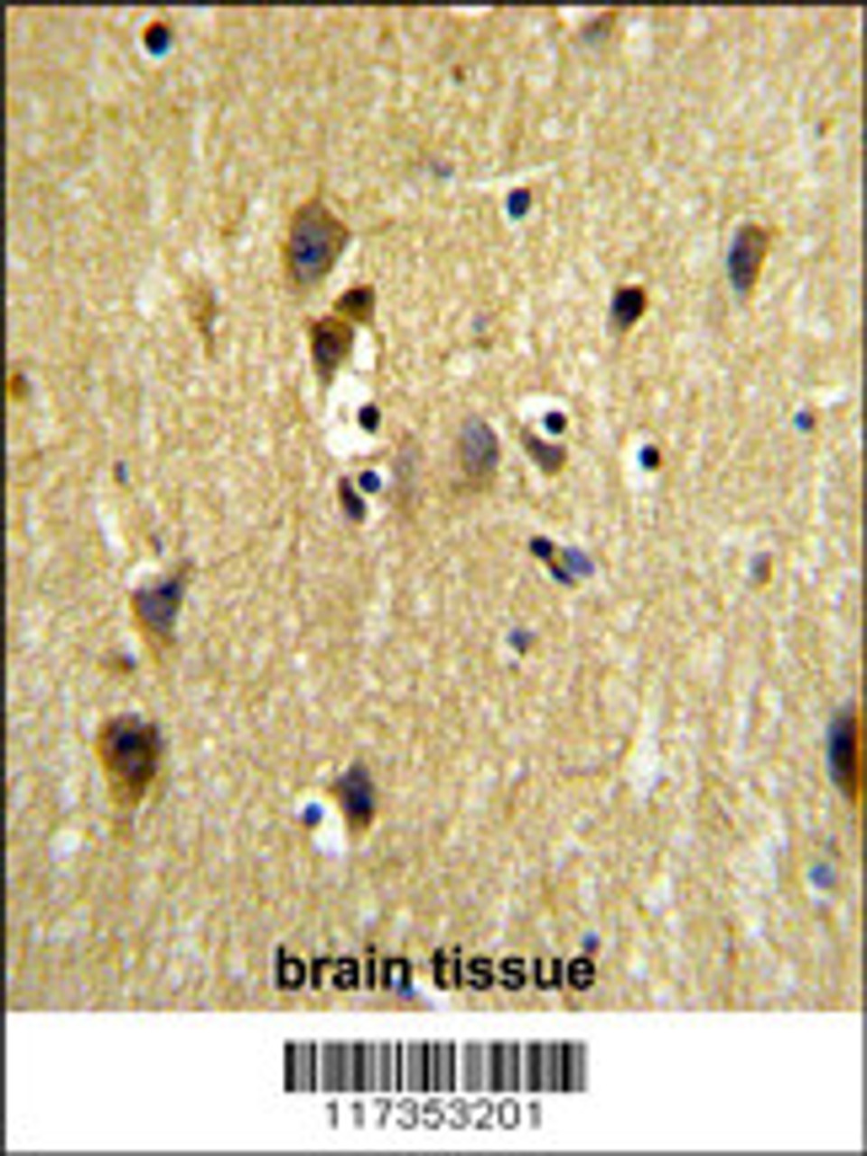 Formalin-fixed and paraffin-embedded human testis tissue reacted with STIP1 Antibody, which was peroxidase-conjugated to the secondary antibody, followed by DAB staining.