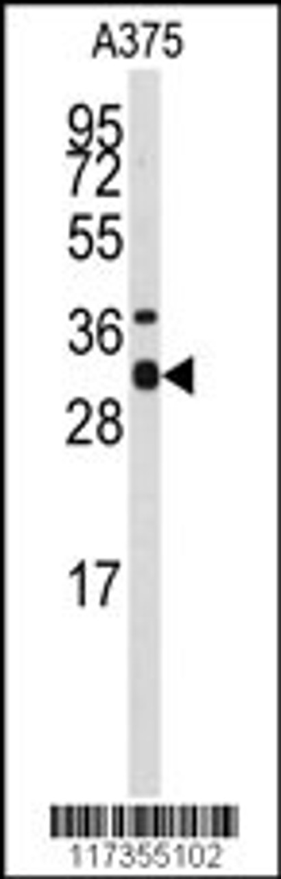 Western blot analysis of anti-STX3 Antibody in A375 cell line lysates (35ug/lane)