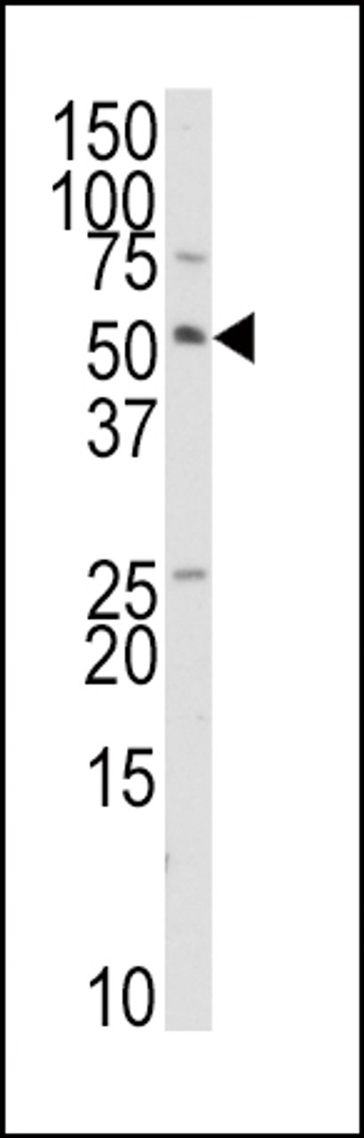 Western blot analysis of anti-TRAIP Antibody in HepG2 cell line lysates (35ug/lane) .
