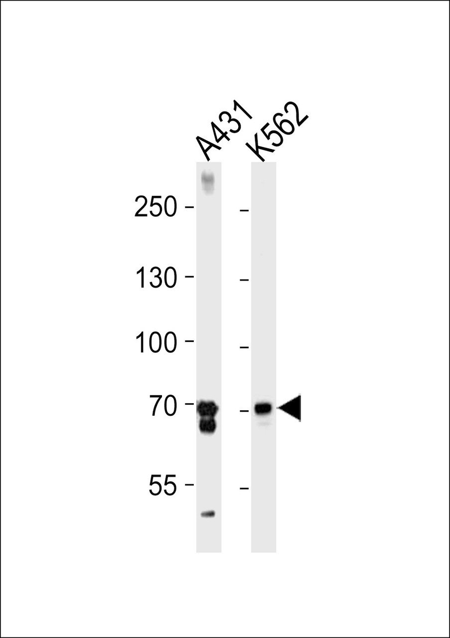 Western blot analysis in A431, K562 cell line lysates (35ug/lane) .